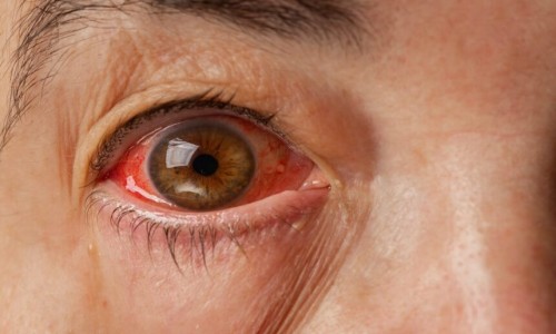 大腿小腿抽脂肪对身体有害吗-【大腿小腿内的脂肪怎么减掉】大小腿脂肪多怎么减 - 大腿小腿的脂肪怎么减掉网